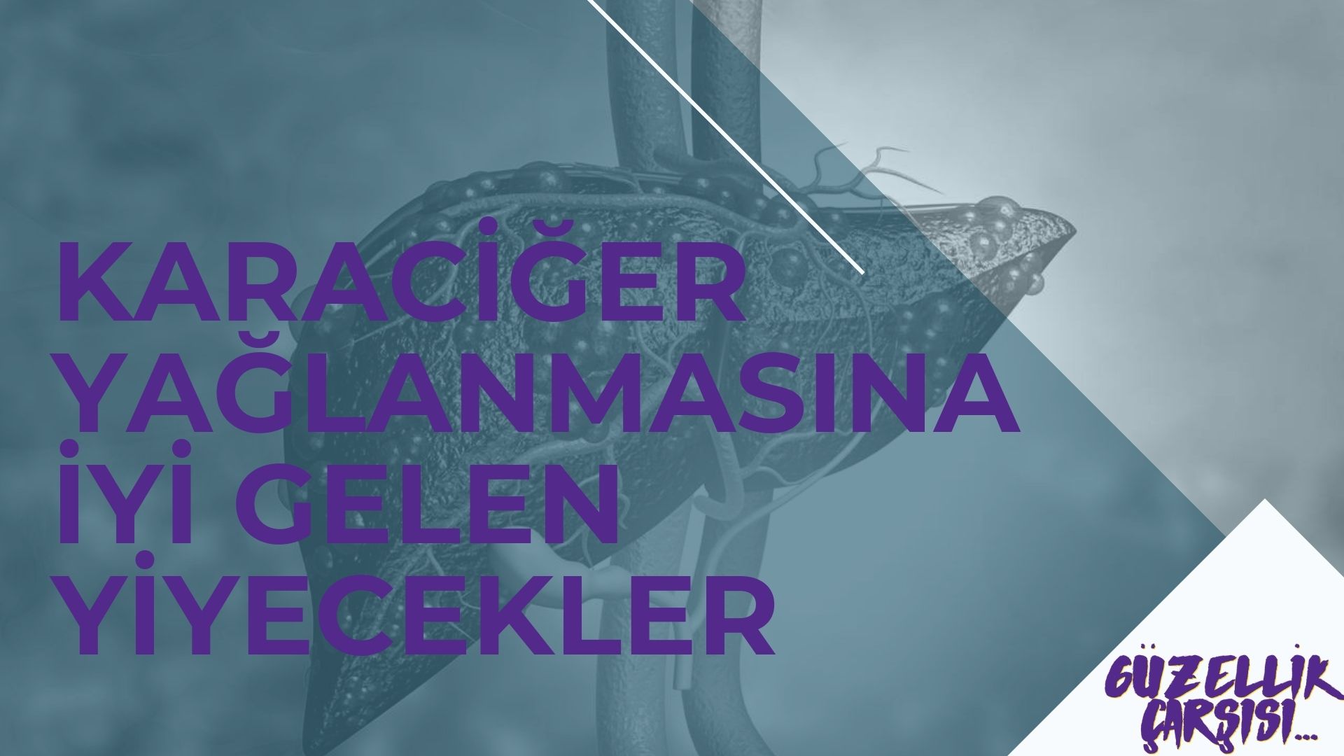 Karaciğer Yağlanmasına İyi Gelen Yiyecekler | Karaciğer Yağlanmasına İyi Gelen 9 Besin