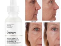 The Ordinary Hyaluronik Asit Yorumları