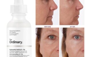 The Ordinary Hyaluronik Asit Yorumları
